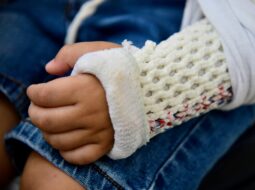 reclaiming-strength-after-the-crash-a-complete-guide-to-functional-recovery-following-auto-accidents